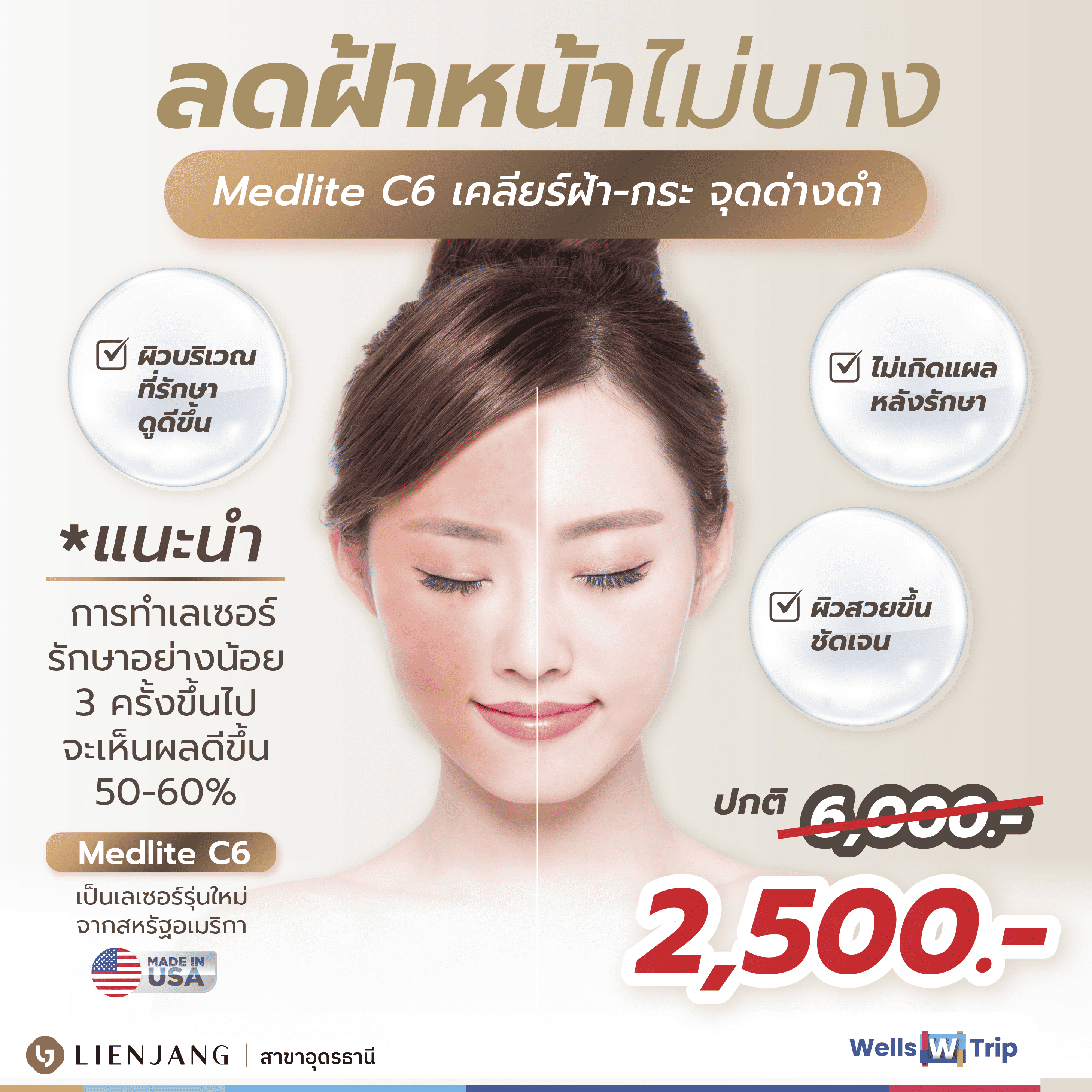 Reduce dark spots on the face with the Medlite C6 machine Super value promotion, 3 times for 3000 baht